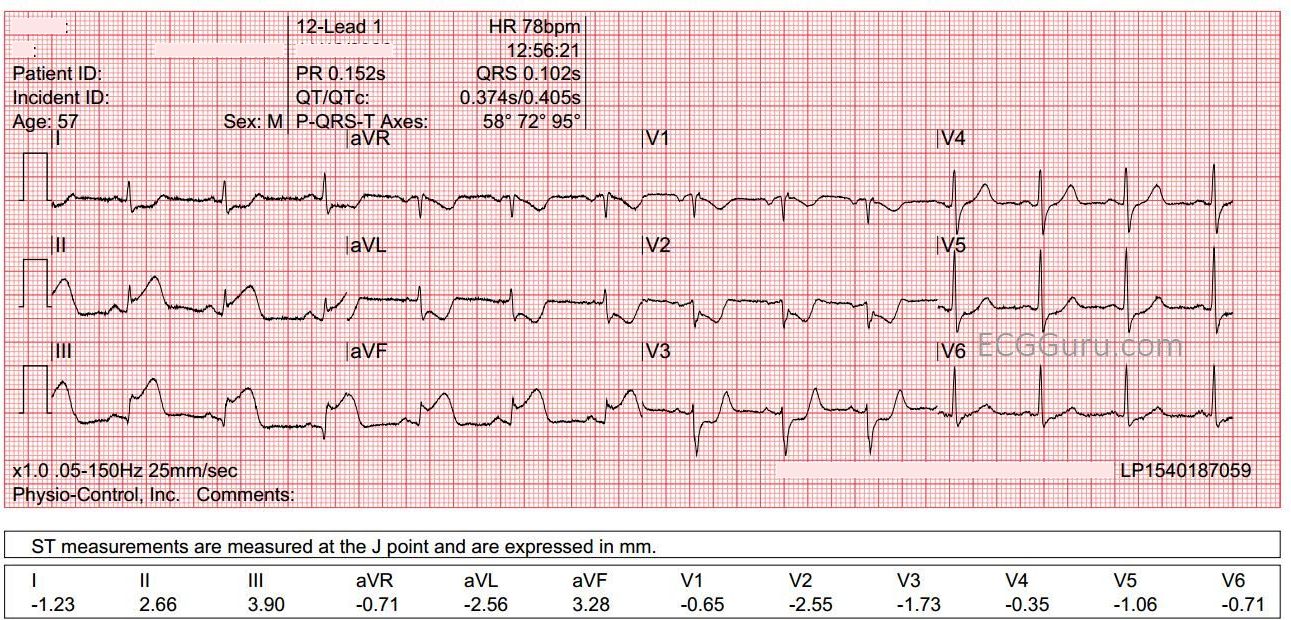 IWMI ECG Guru Instructor Resources iwmi-ecg-guru-instructor-resources